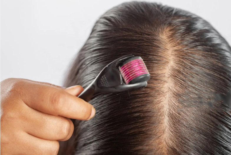 Best Hair Derma Rollers